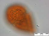 Gymnodinium_helveticum_1254225095