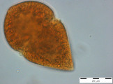 Gymnodinium_helveticum_1254225426