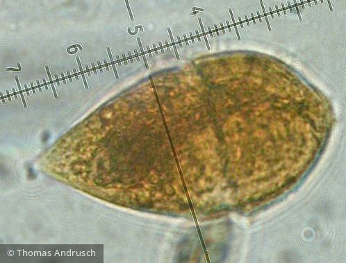 Dinophyta Dinophyceae Gymnodiniales Gyrodinium helveticum