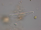 Eunotia_incisa_1273060538