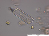 Eunotia_incisa_1273061605