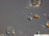 Cyclostephanos_invisitatus_1274261119