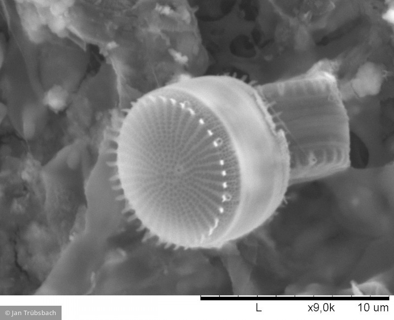 Heterocontophyta Bacillariophyceae Centrales Cyclostephanos invisitatus