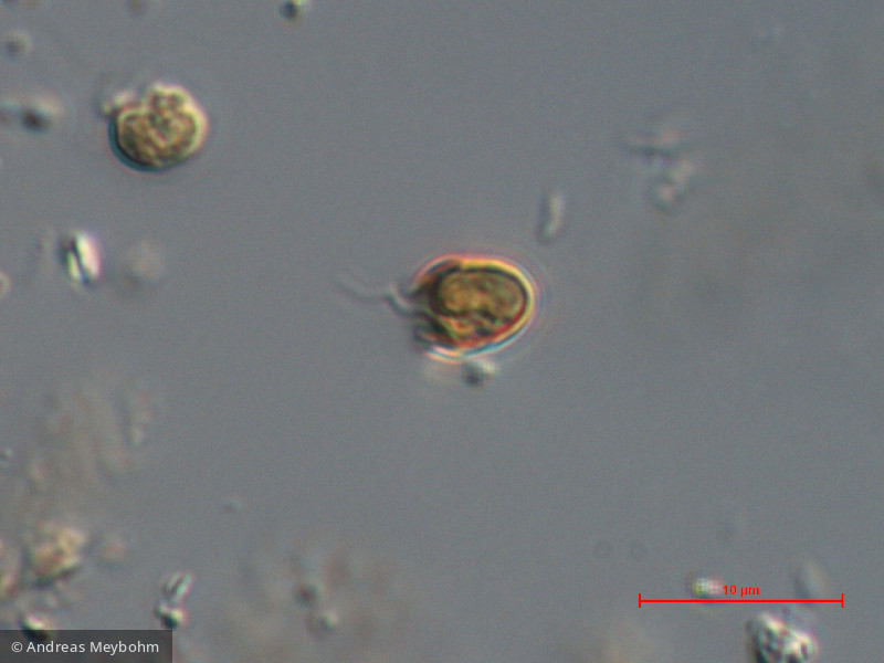 Heterocontophyta Chrysophyceae Chromulinales Kephyrion littorale