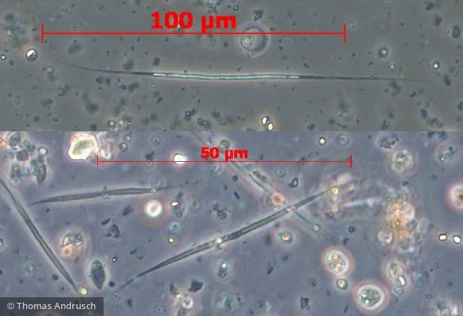 Chlorophyta Ulvophyceae Ulotrichales Koliella longiseta
