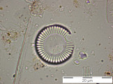 Cyclotella_meneghiniana_1228409253