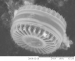Cyclotella_meneghiniana_1233933356