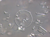 Cyclotella_meneghiniana_1265979348