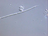 Limnothrix_obliqueacuminata_1232436352
