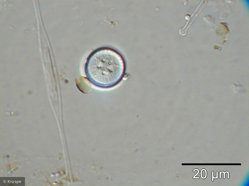 Cyclotella_ocellata_1260527559 - Heterocontophyta Bacillariophyceae Centrales Cyclotella ocellata