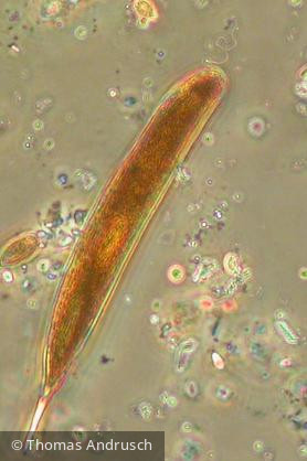Euglena_oxyuris_1271445264 - Euglenophyta Euglenophyceae Euglenales Lepocinclis oxyuris