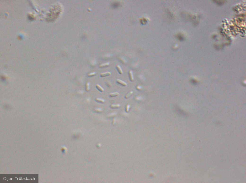 Lemmermanniella_pallida_1253542755 - Cyanobacteria Cyanobacteria Chroococcales Lemmermanniella pallida