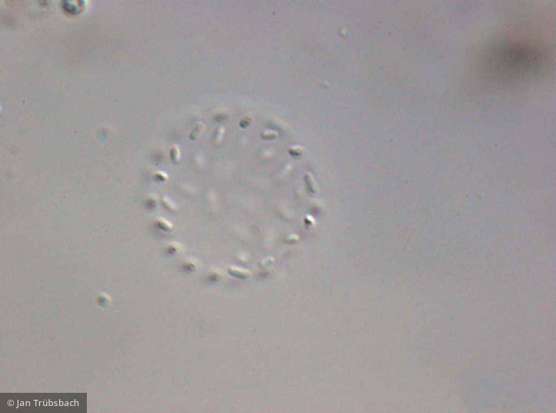 Lemmermanniella_pallida_1253542843 - Cyanobacteria Cyanobacteria Chroococcales Lemmermanniella pallida