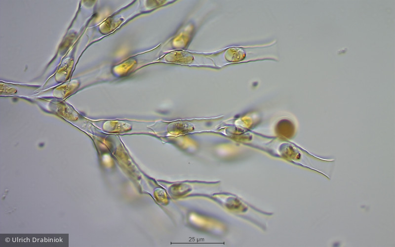 Heterocontophyta Chrysophyceae Ochromonadales Dinobryon pediforme