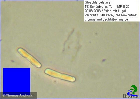 Gloeotila_pelagica_1238687129 - Chlorophyta Klebsormidiophyceae Klebsormidiales Stichococcus pelagicus