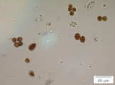 Haematococcus_pluvialis_1221907392