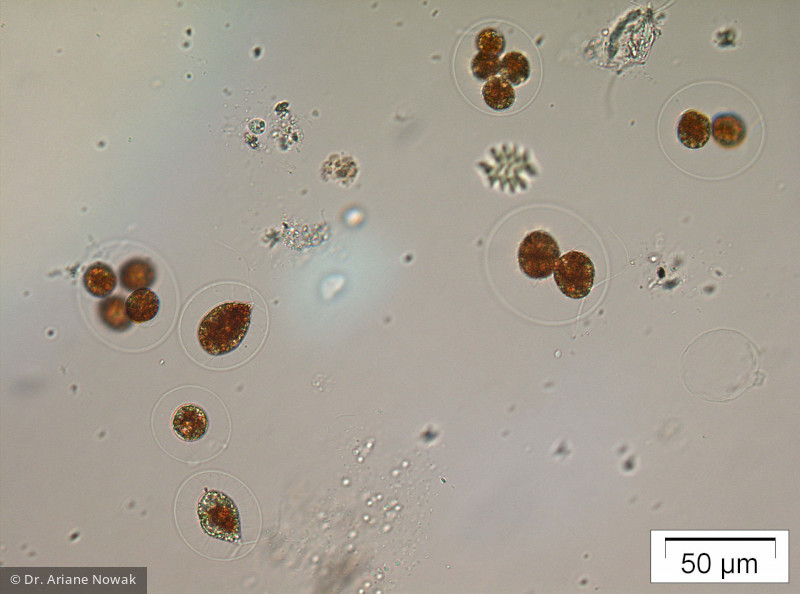 Haematococcus_pluvialis_1221907392 - Chlorophyta Chlorophyceae Volvocales Haematococcus pluvialis