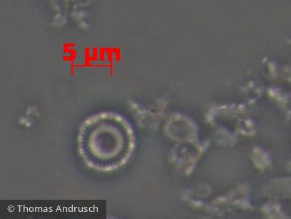 Heterocontophyta Bacillariophyceae Centrales Discostella pseudostelligera