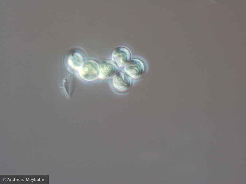 Dictyospaerium_pulchellum_1220886982 - Chlorophyta Chlorophyceae Chlorococcales Mucidosphaerium pulchellum