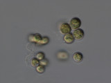 Dictyospaerium_pulchellum_1220885737