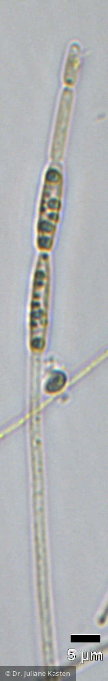 Cyanobacteria Cyanobacteria Nostocales Cylindrospermopsis raciborskii