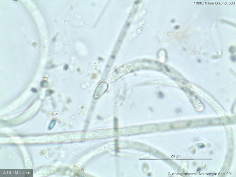 Cyanobacteria Cyanobacteria Nostocales Cylindrospermopsis raciborskii