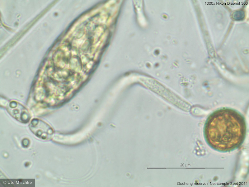 Cyanobacteria Cyanobacteria Nostocales Cylindrospermopsis raciborskii