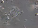 Cyclotella_radiosa_1265981181