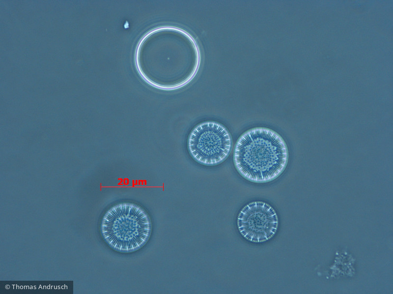 Heterocontophyta Bacillariophyceae Centrales Cyclotella radiosa