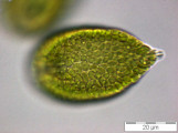 Gonyostomum_semen_1253181449