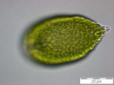 Gonyostomum_semen_1253182197