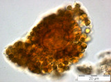 Gonyostomum_semen_1253186756