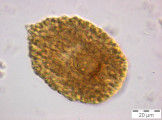 Gonyostomum_semen_1253187997