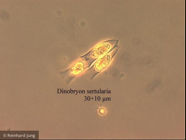 Dinobryon_sertularia_1226585633 - Heterocontophyta Chrysophyceae Ochromonadales Dinobryon sertularia