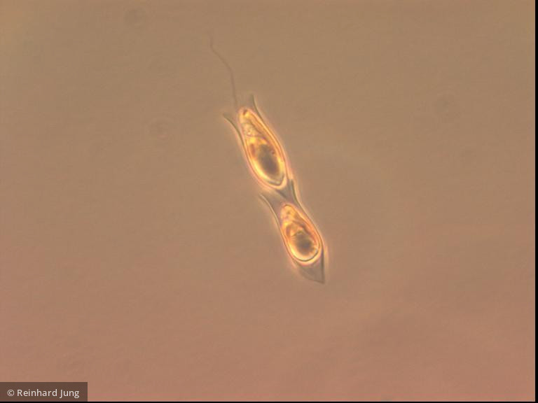 Dinobryon_sertularia_1226585755 - Heterocontophyta Chrysophyceae Ochromonadales Dinobryon sertularia