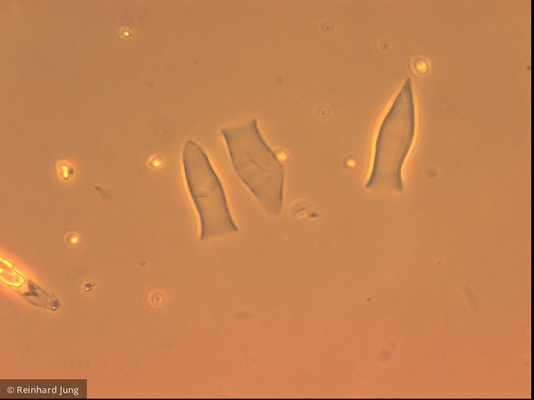 Dinobryon_sertularia_1226585835 - Heterocontophyta Chrysophyceae Ochromonadales Dinobryon sertularia
