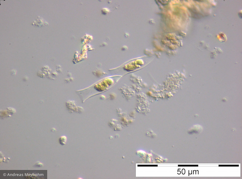 Dinobryon_sertularia_1227888352 - Heterocontophyta Chrysophyceae Ochromonadales Dinobryon sertularia