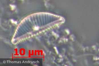 Heterocontophyta Bacillariophyceae Pennales Encyonema silesiacum