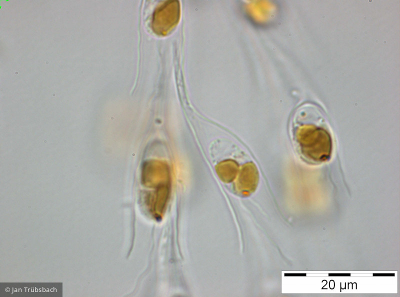 Dinobryon_sociale_1249992767 - Heterocontophyta Chrysophyceae Ochromonadales Dinobryon sociale