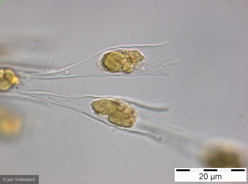 Dinobryon_sociale_1249997222 - Heterocontophyta Chrysophyceae Ochromonadales Dinobryon sociale