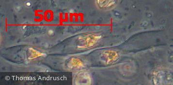 Heterocontophyta Chrysophyceae Ochromonadales Dinobryon sociale