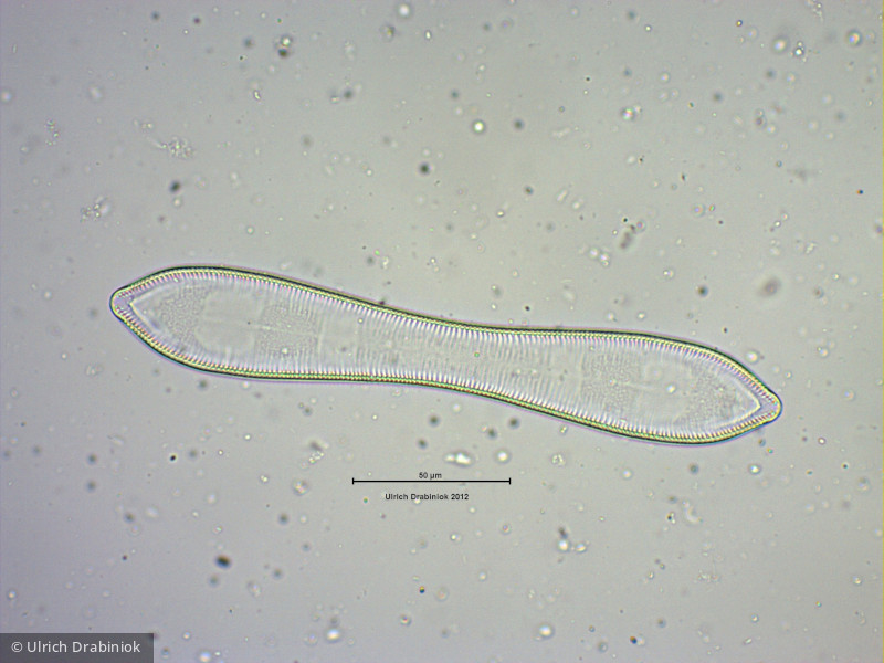 Heterocontophyta Bacillariophyceae Pennales Cymatopleura solea