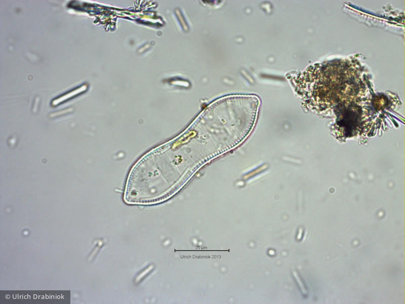 Heterocontophyta Bacillariophyceae Pennales Cymatopleura solea