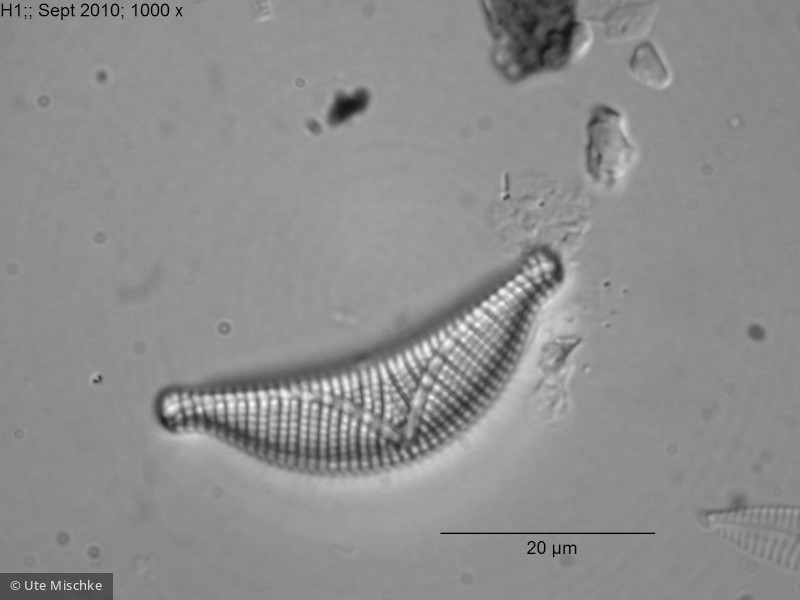 Heterocontophyta Bacillariophyceae Pennales Epithemia sorex