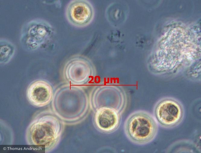 Chlorophyta Chlorophyceae Chlorococcales Eutetramorus sp.