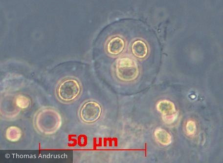 Chlorophyta Chlorophyceae Chlorococcales Gloeocystis sp.