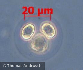 Chlorophyta Chlorophyceae Chlorococcales Gloeocystis sp.