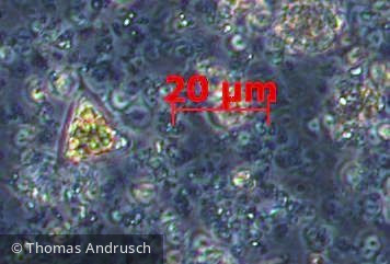 Heterocontophyta Xanthophyceae Mischococcales Goniochloris sp.