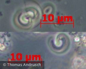 Chlorophyta Chlorophyceae Chlorococcales Kirchneriella sp.