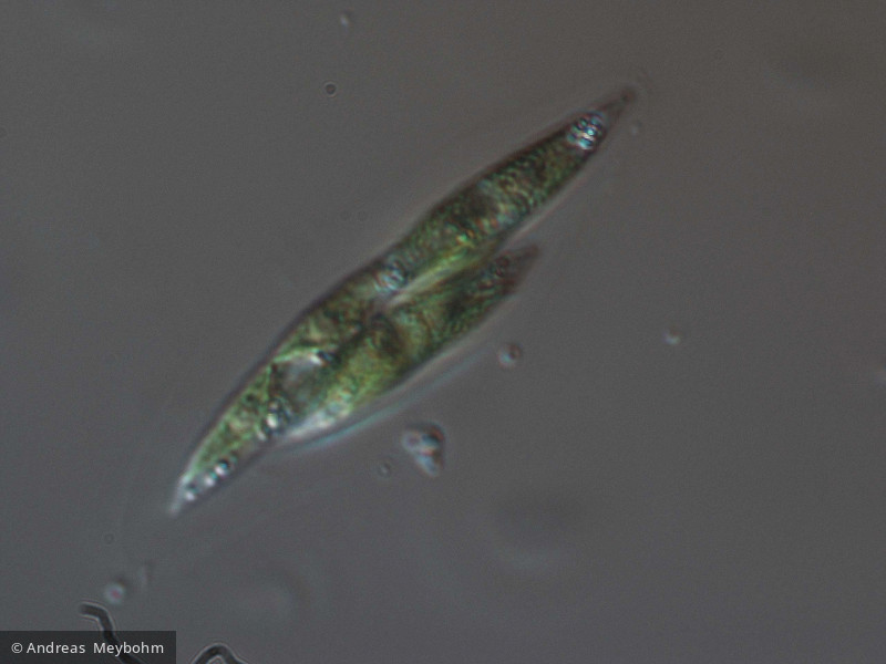 Elakatothrix_sp._1220860861 - Chlorophyta Ulvophyceae Ulotrichales Elakatothrix sp.